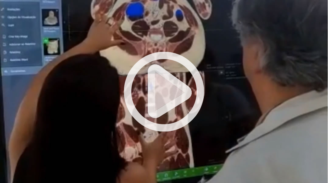 Video de Anatomia Digital - Mesa de Anatomia Digital
